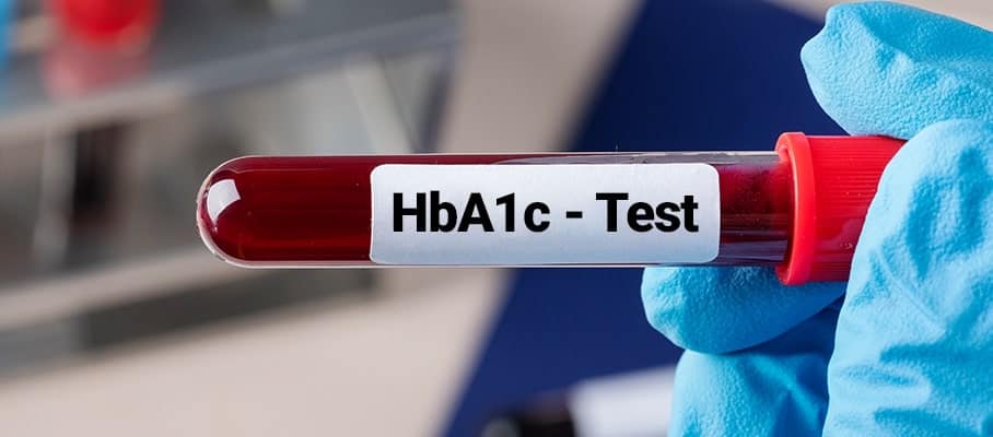 Understanding HbA1c Test Normal Range for Indian Adults Explained